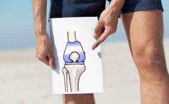 Knee Replacement Surgery Recovery