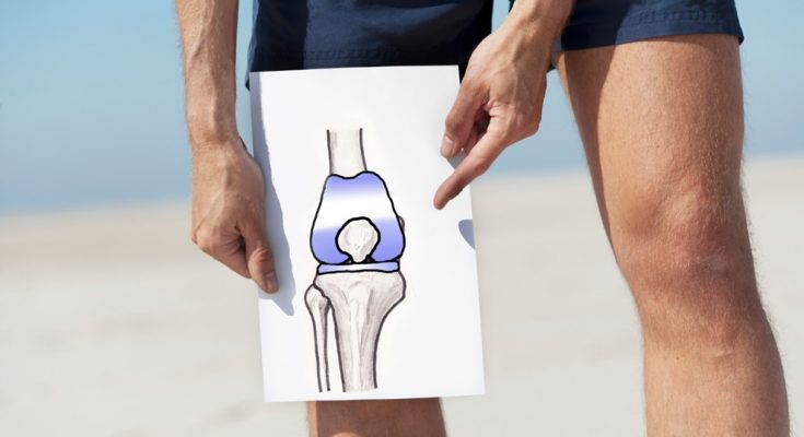 Knee Replacement Surgery Recovery