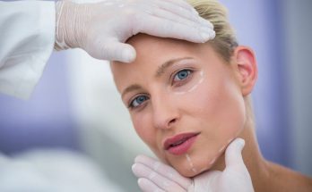 Thread Facelift and IV Therapy